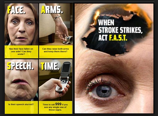 Graphic from the Act F.A.S.T campaign